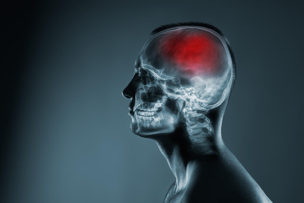fresno brain injury lawyer