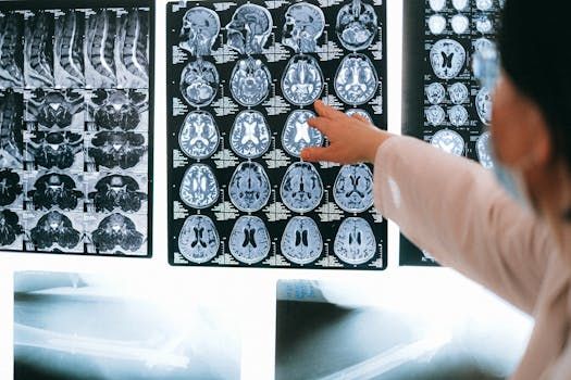 Brain MRI scan — traumatic brain injury settlement value California