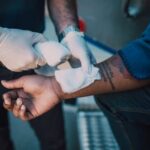 Dog bite injury treatment — what to do after dog bite Fresno California