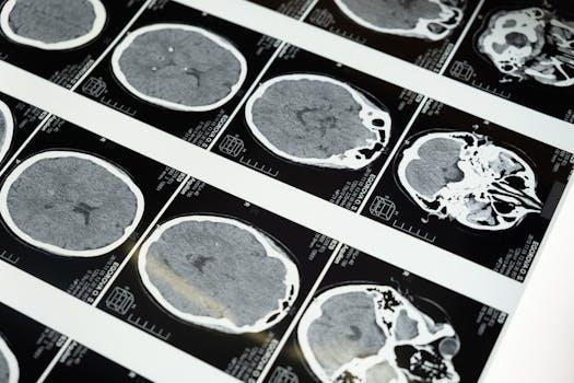 CT scan — Visalia traumatic brain injury lawyer
